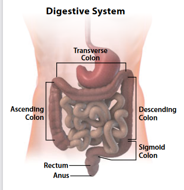 Colectomy