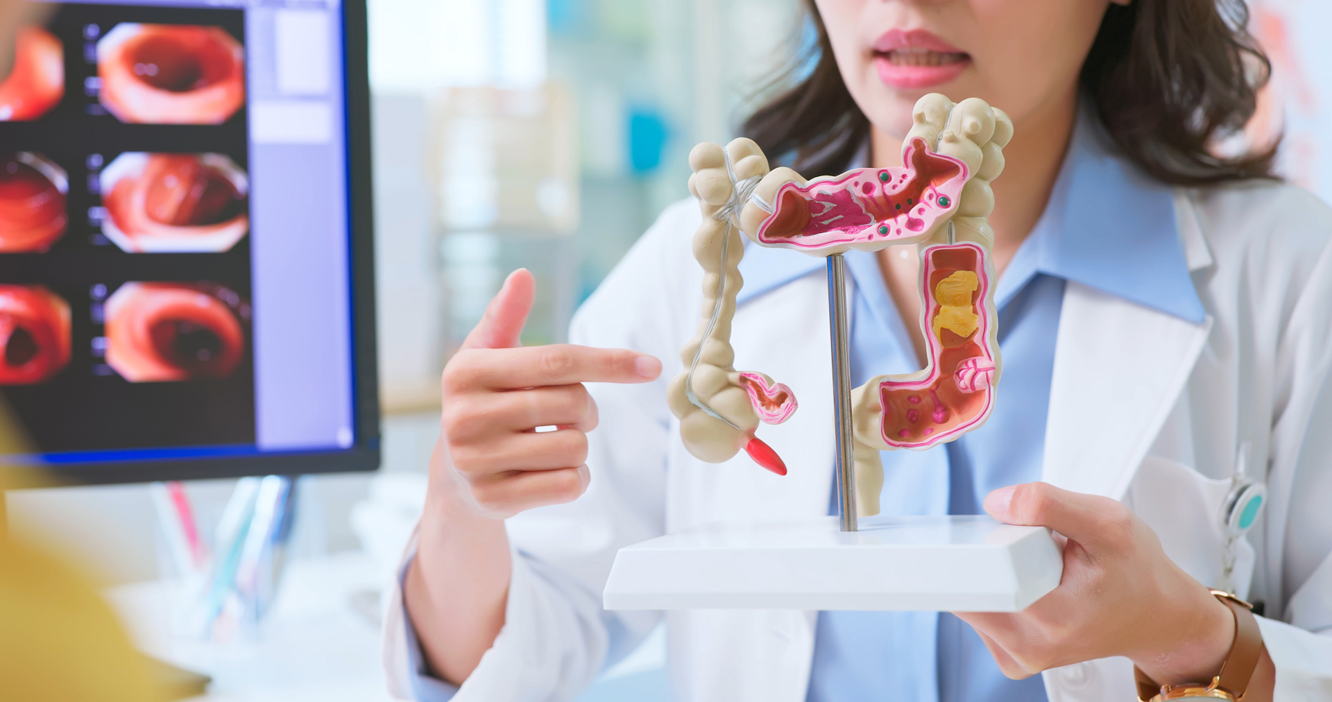 Colorectal Cancer